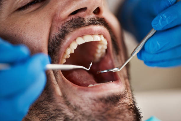 Best Emergency Broken Tooth Repair in Stockton, IL